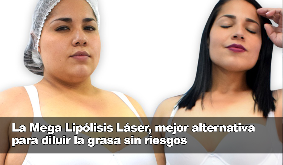 Olvídate de la grasa indeseada con la Mega Lipólisis Láser