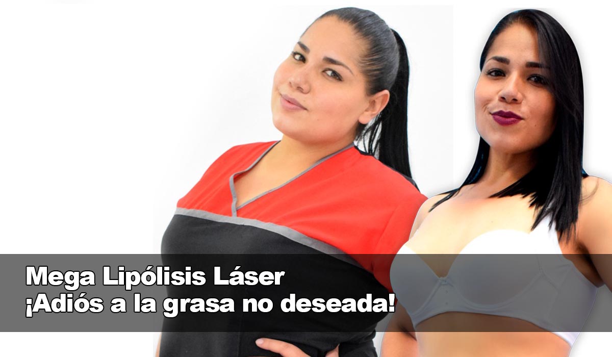 La Mega Lipólisis Láser, la solución efectiva para eliminar la grasa no deseada